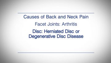 Causes of Back and Neck Pain