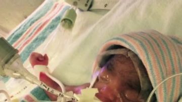 Baby Samoi Goes Home After 114 Days at Joe DiMaggio Children’s Hospital’s NICU