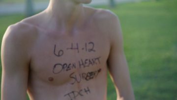 Highly Ranked Pediatric Cardiology, Heart Surgery Program Helps Johnny Race