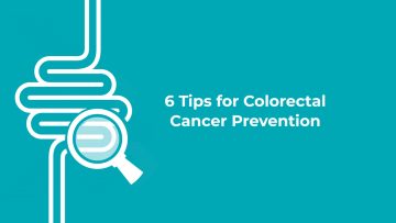 6 Tips for Colorectal Cancer Prevention from Dr. Christopher Gannon
