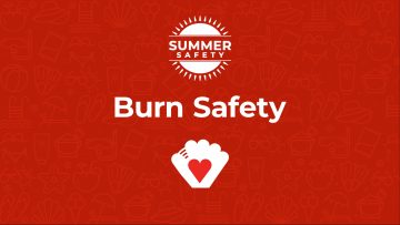 Summer Burn Safety Tips