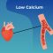 Heart Calcium Scoring CT Scan – Memorial Cardiac and Vascular Institute